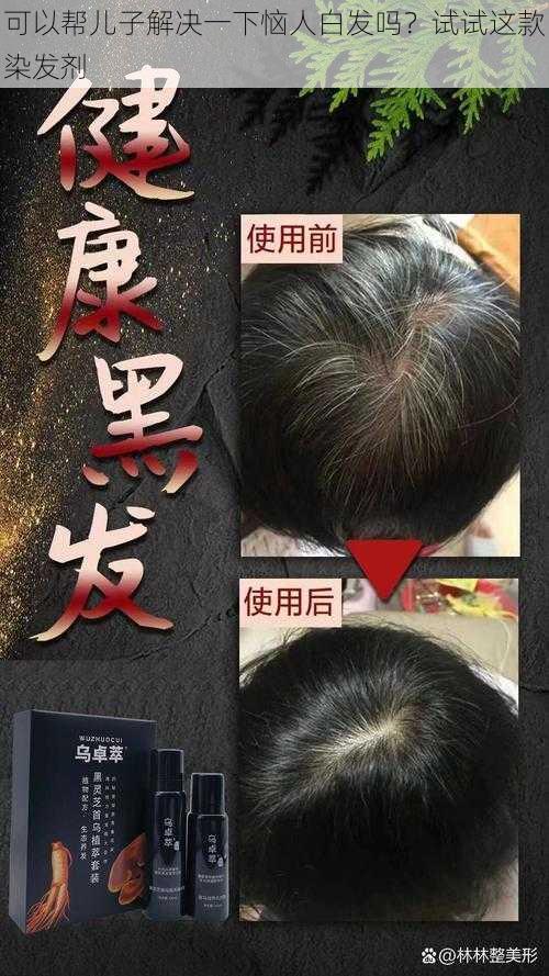 可以帮儿子解决一下恼人白发吗？试试这款染发剂