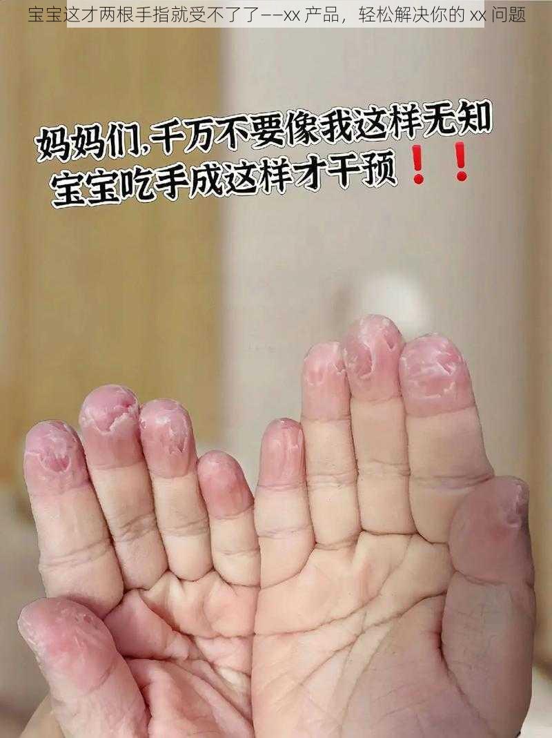 宝宝这才两根手指就受不了了——xx 产品，轻松解决你的 xx 问题