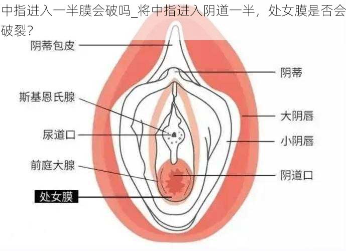 中指进入一半膜会破吗_将中指进入阴道一半，处女膜是否会破裂？